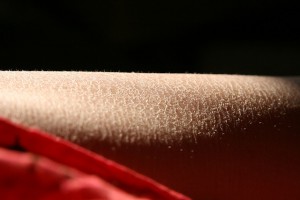 Kuivuuteen taipuvainen iho tarvitsee lisäkosteutusta talvella (Kuva: Quinn Dombrowski CC BY-SA 2.0)